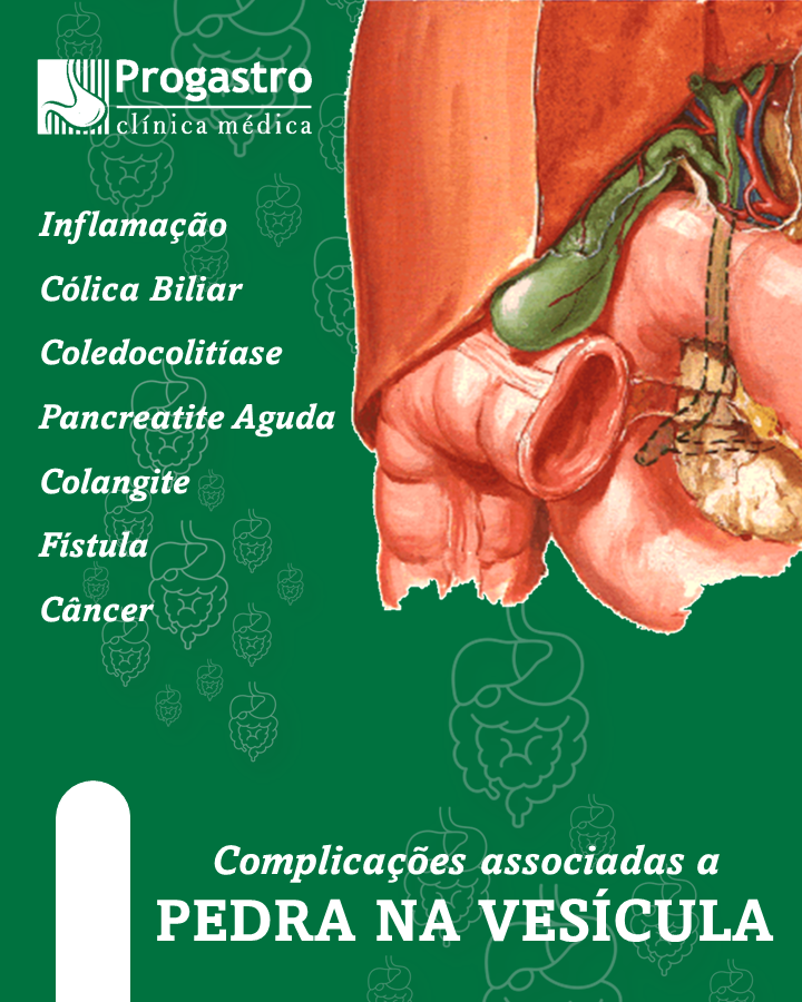Pedra na Vesícula