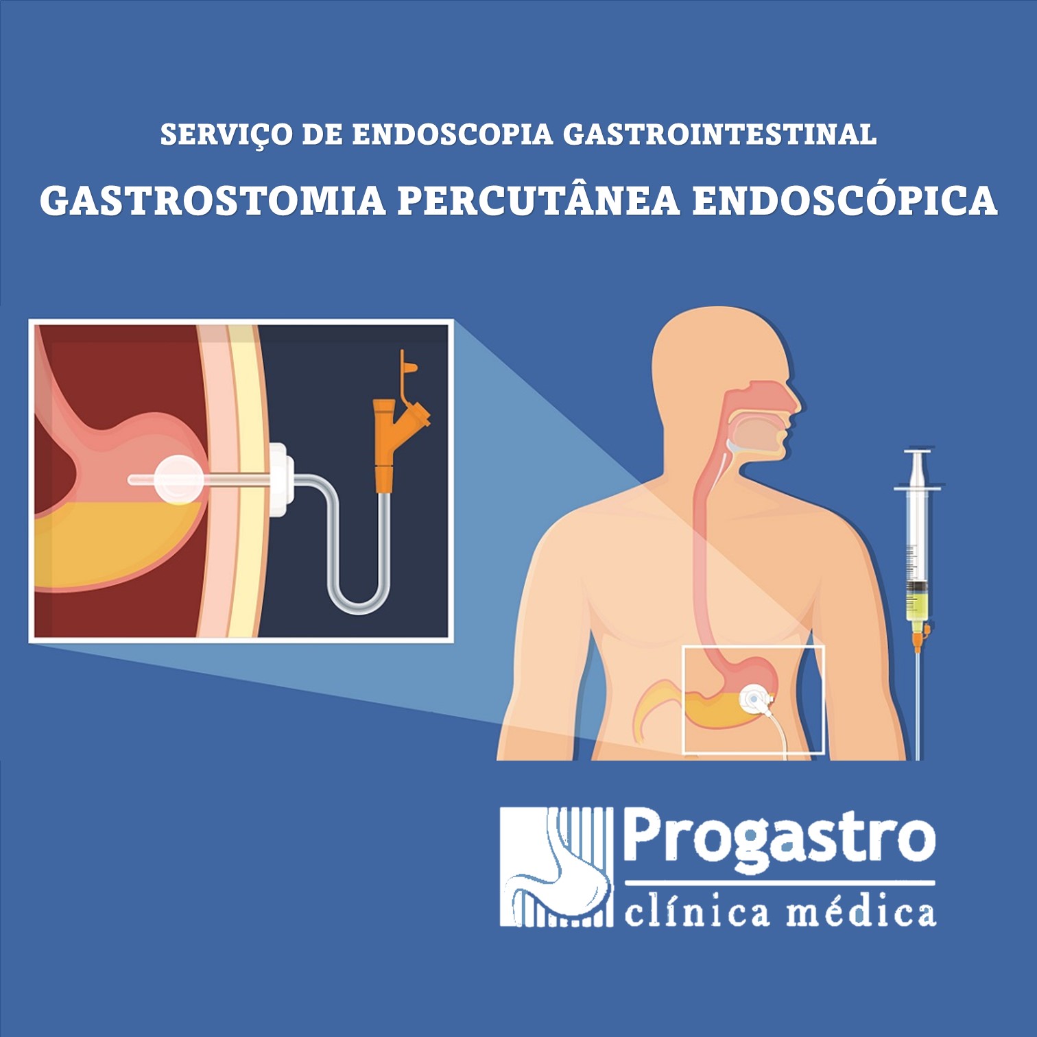 GTT – Instituto PROGASTRO